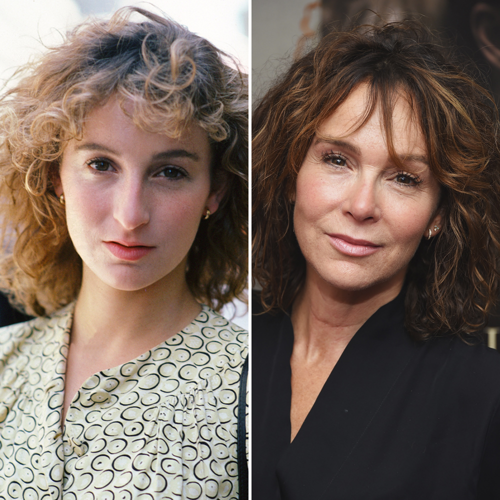 Jennifer Grey et la chirurgie esthétique