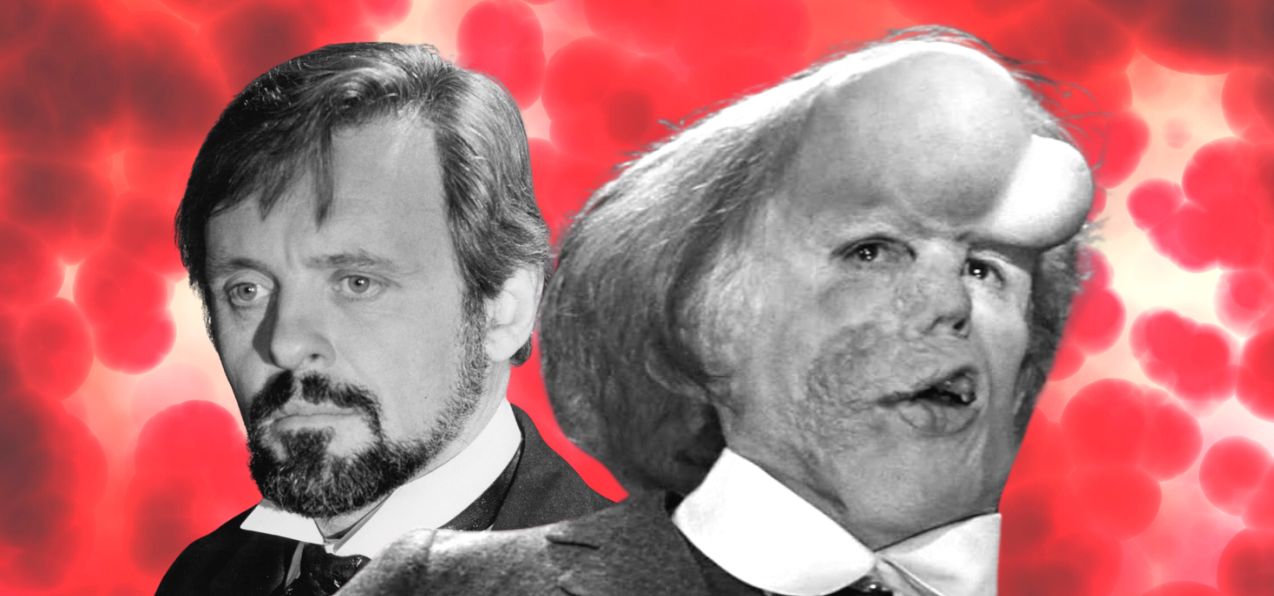 Elephant Man, une histoire vraie : le film de monstre le plus dérangeant (et le plus beau)