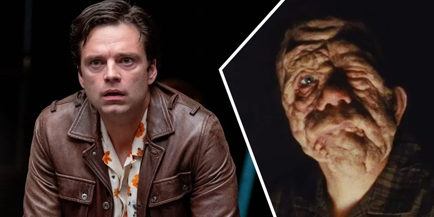Sebastian Stan arrête un journaliste qui l'a qualifié de défiguré
