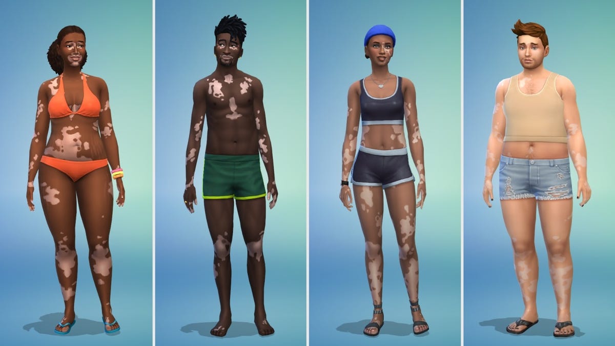 Les Sims 4 ajoute des options de skin Vitiligo dans une mise à jour gratuite