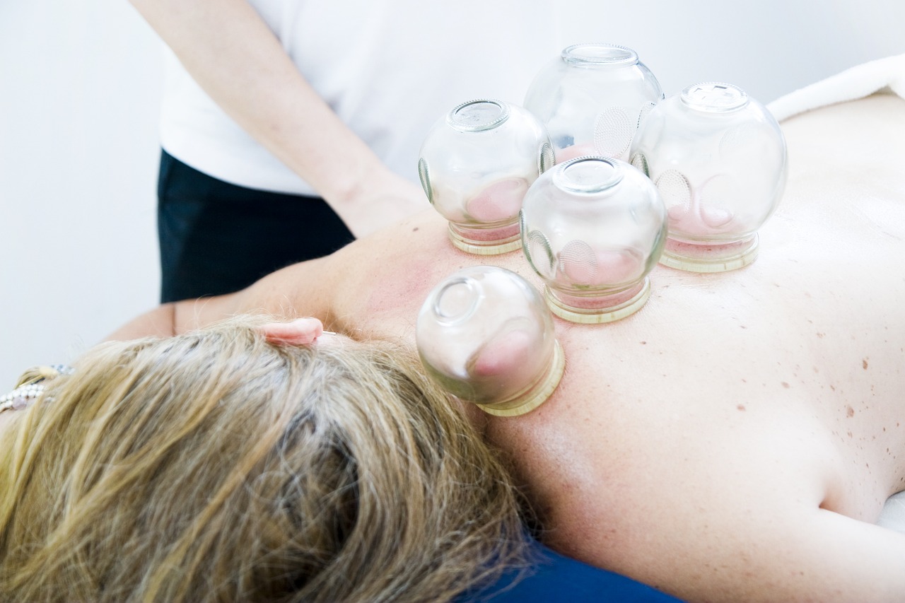 cupping therapy 6604217 1280