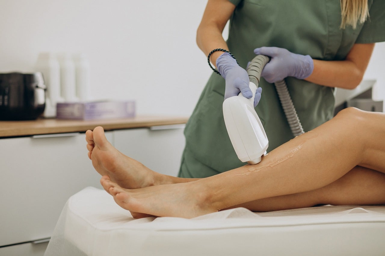 épilation laser